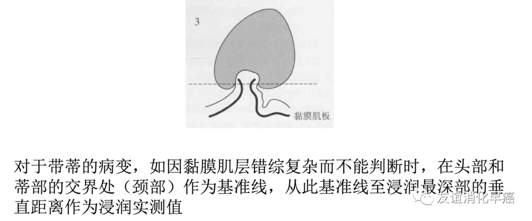 fe081be4d288b302980a6a23b5bae103.png